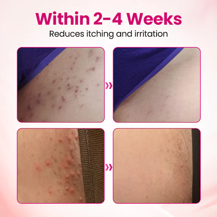 Timilk® IntiDefend Anti-HPV Interferon Gel 8 Timilk® IntiDefend Anti-HPV Interferon Gel