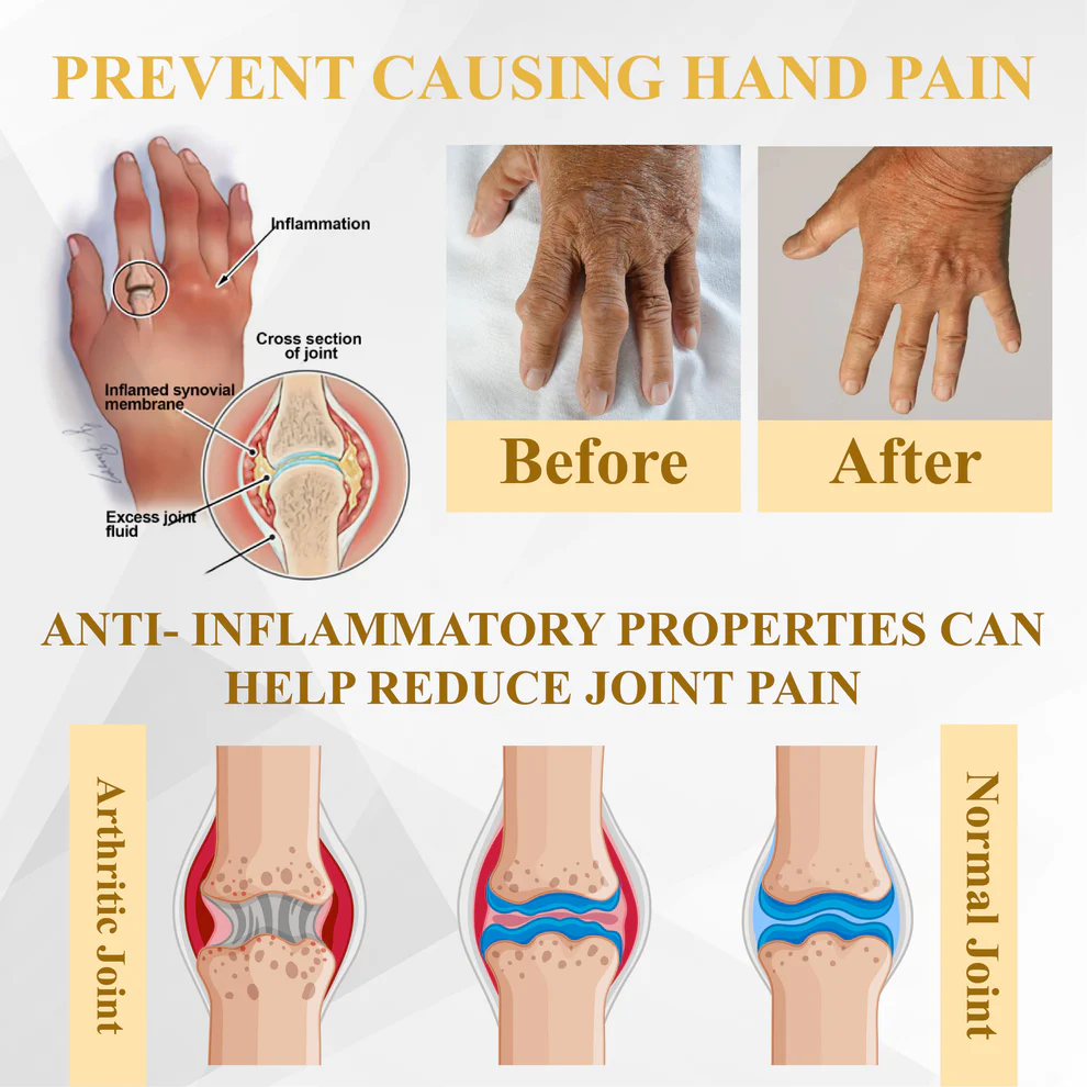 ATTDX® ApiMotion Herbal Joint Comfort Balm 7 ATTDX® ApiMotion Herbal Joint Comfort Balm