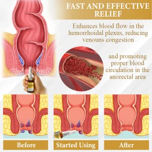 ATTDX® Apis Venom Hemorrhoid Cooling Spray 11 ATTDX® Apis Venom Hemorrhoid Cooling Spray