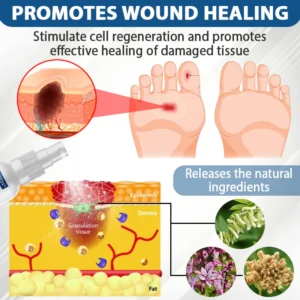 CVREOZ® Diabetes Foot Guard Fast Recovery Spray 20 CVREOZ® Diabetes Foot Guard Fast Recovery Spray