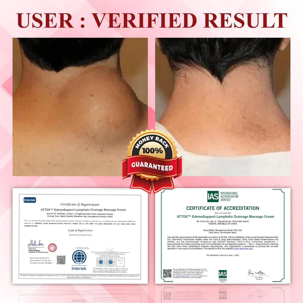 ATTDX® EdemaCare Lymphatic Drainage Massage Cream 6 ATTDX® EdemaCare Lymphatic Drainage Massage Cream