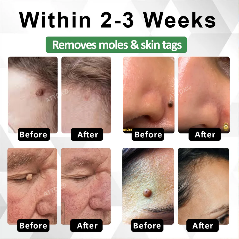 ATTDX® Herdle Shot Spot & Mole Correct Serum 2 ATTDX® Herdle Shot Spot & Mole Correct Serum