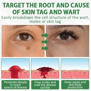 ATTDX® Herdle Shot Spot & Mole Correct Serum 16 ATTDX® Herdle Shot Spot & Mole Correct Serum