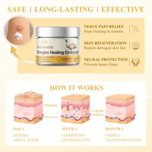 ATTDX® NervoSoothe Shingles Healing Ointment 19 ATTDX® NervoSoothe Shingles Healing Ointment