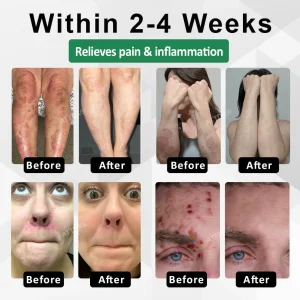 ATTDX® Snake Peptide Shingles Skincare Ampoules 12 ATTDX® Snake Peptide Shingles Skincare Ampoules