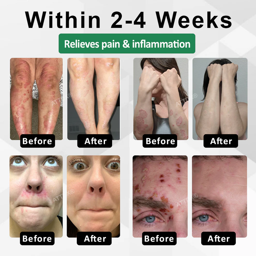 ATTDX® Snake Peptide Shingles Skincare Ampoules 3 ATTDX® Snake Peptide Shingles Skincare Ampoules