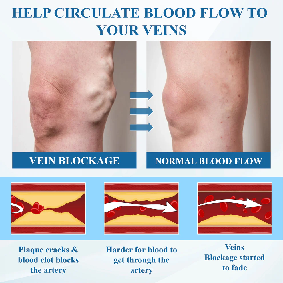 ATTDX® VeinFocus Microneedle Leg Patch 11 ATTDX® VeinFocus Microneedle Leg Patch