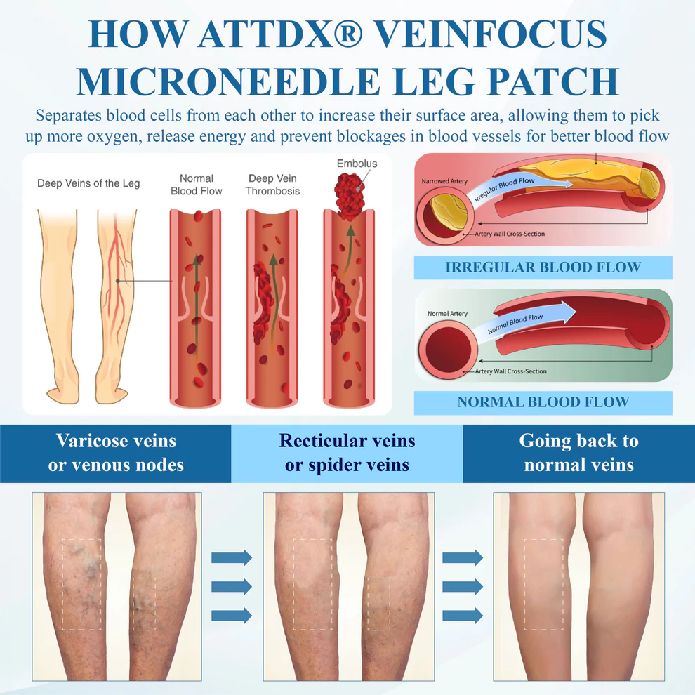 ATTDX® VeinFocus Microneedle Leg Patch 9 ATTDX® VeinFocus Microneedle Leg Patch