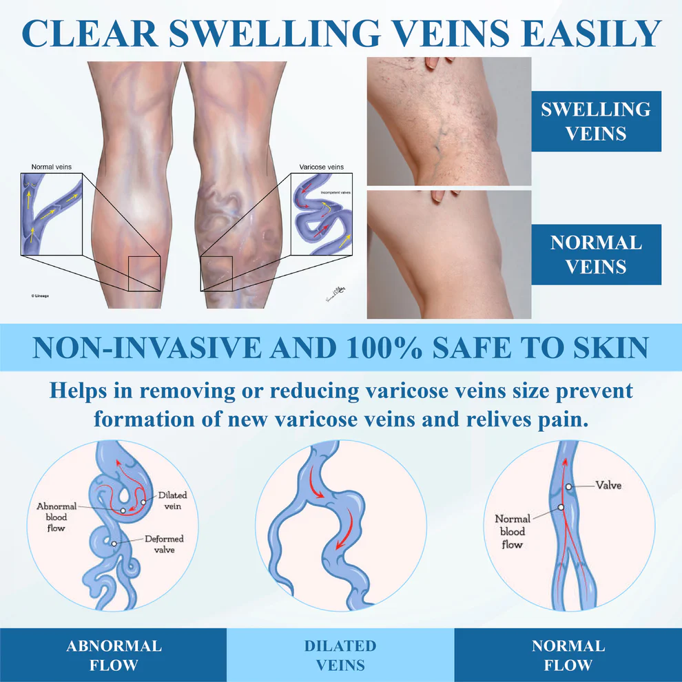 ATTDX® VeinFocus Microneedle Leg Patch 8 ATTDX® VeinFocus Microneedle Leg Patch