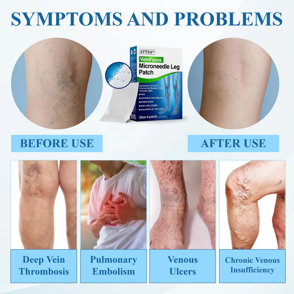 ATTDX® VeinFocus Microneedle Leg Patch 7 ATTDX® VeinFocus Microneedle Leg Patch