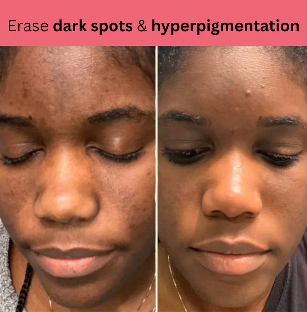 Kojic Acid Turmeric Overnight Mask 9 Kojic Acid Turmeric Overnight Mask