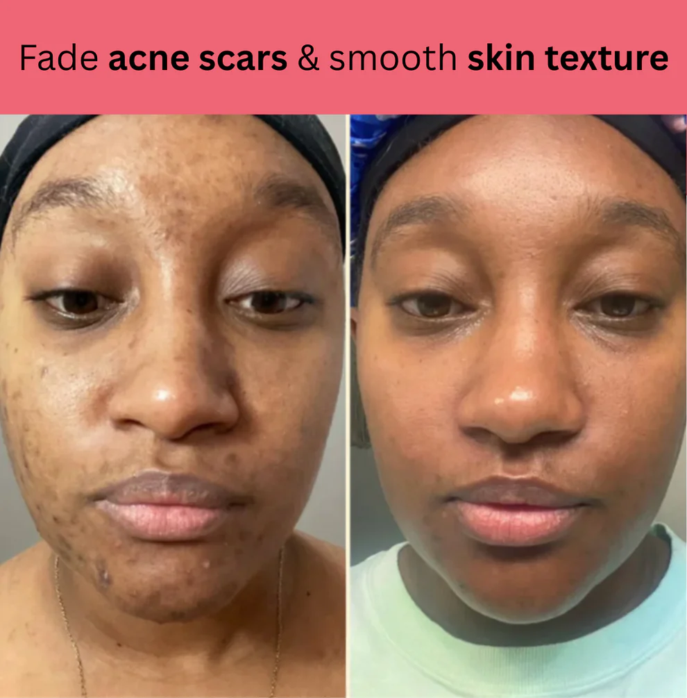 Kojic Acid Turmeric Overnight Mask 8 Kojic Acid Turmeric Overnight Mask