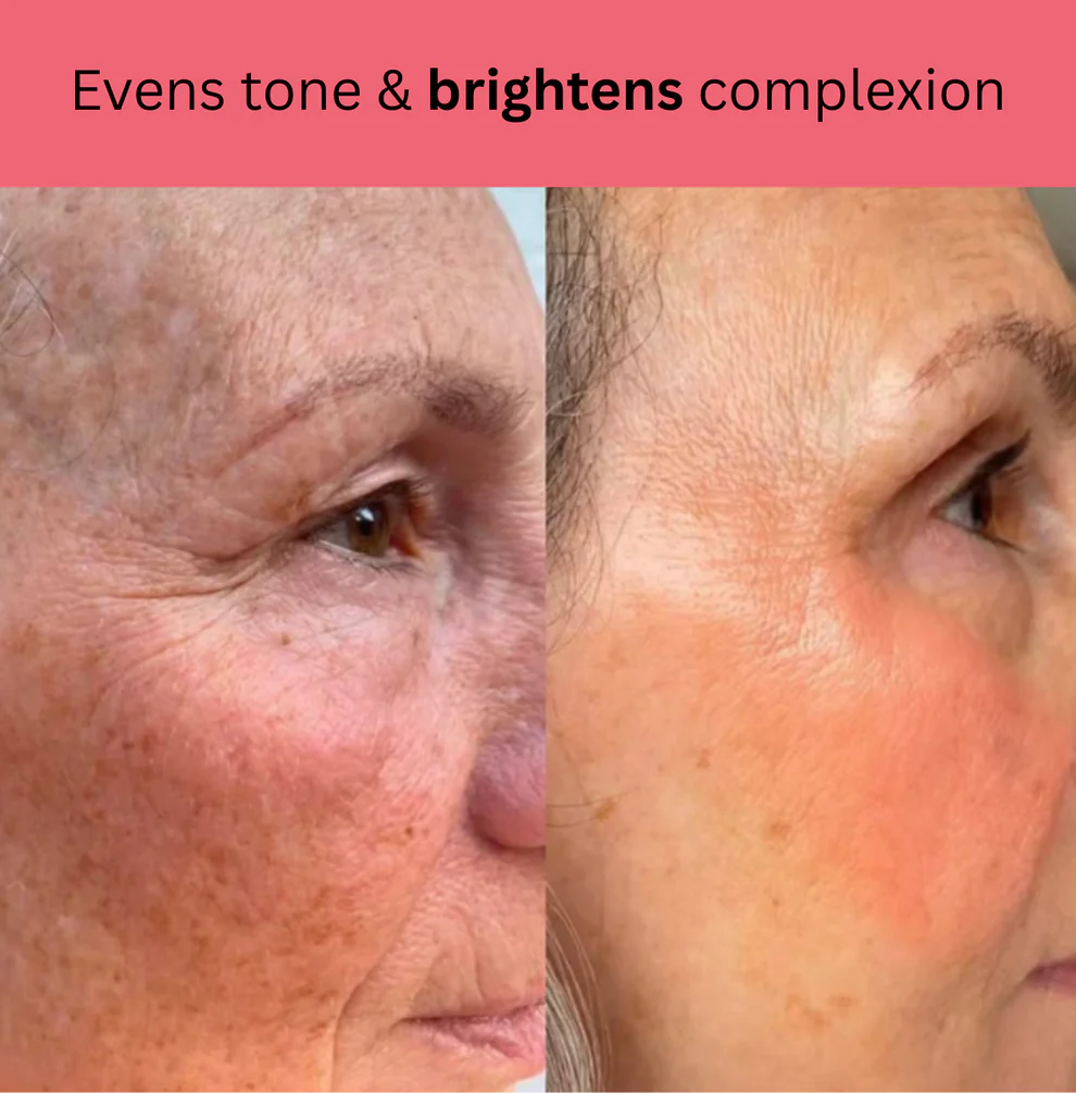 Kojic Acid Turmeric Overnight Mask 5 Kojic Acid Turmeric Overnight Mask