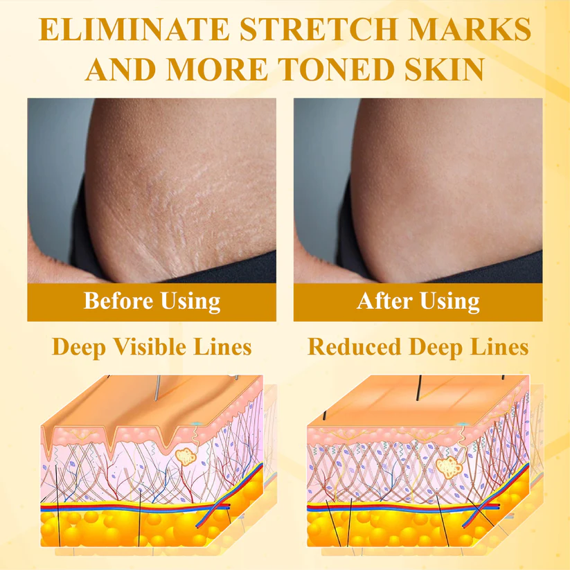 Holikea™ BotoxBee Advanced Multi-Action FirmingCream 100g 9 Holikea™ BotoxBee Advanced Multi-Action FirmingCream 100g