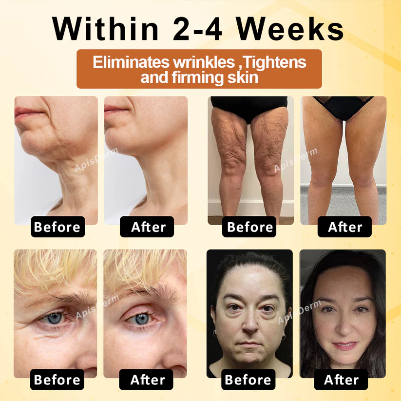 Holikea™ BotoxBee Advanced Multi-Action FirmingCream 100g 4 Holikea™ BotoxBee Advanced Multi-Action FirmingCream 100g