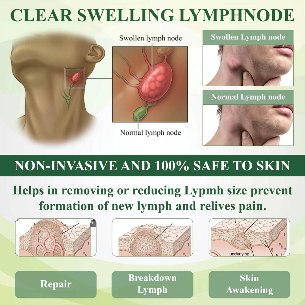 ATTDX® ClearCirculate Soursop Edema Detox Drops 3 ATTDX® ClearCirculate Soursop Edema Detox Drops