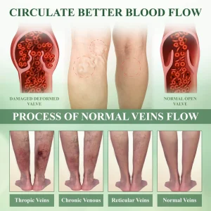 ATTDX® ChestnutEase Edema Massage Herbal Cream