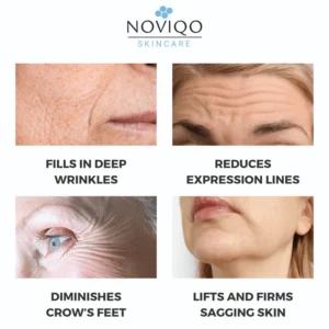 Noviqo™ – Anti-Wrinkle Freeze-Dried Nano-Silk Collagen System 8 Noviqo™ – Anti-Wrinkle Freeze-Dried Nano-Silk Collagen System