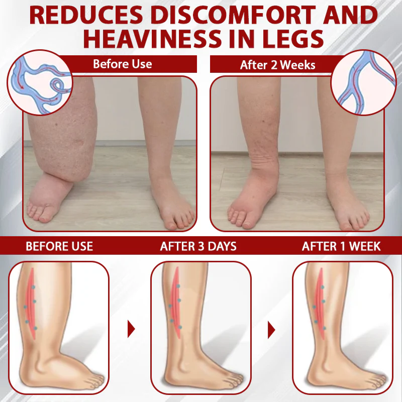 ATTDX® Red Vine FluidRelief Edema Gel 5 ATTDX® Red Vine FluidRelief Edema Gel