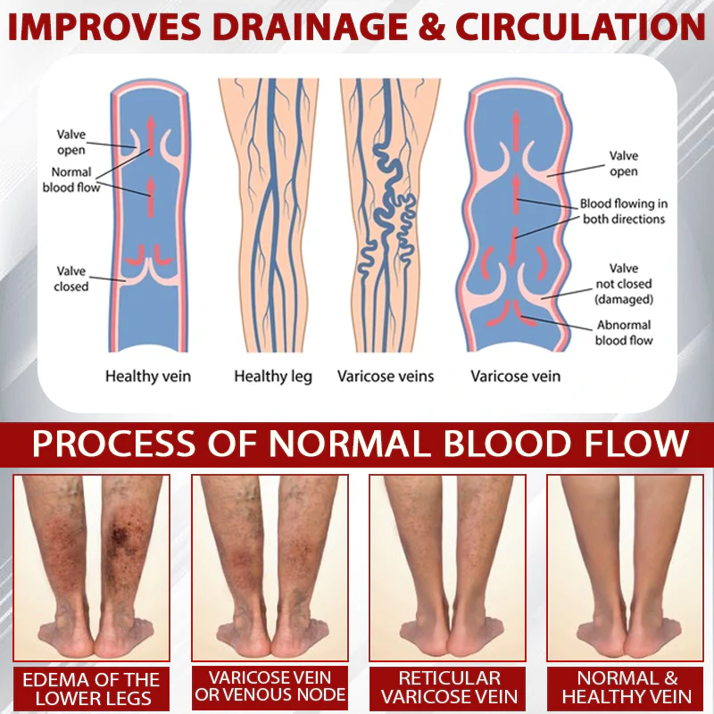 ATTDX® Red Vine FluidRelief Edema Gel 3 ATTDX® Red Vine FluidRelief Edema Gel