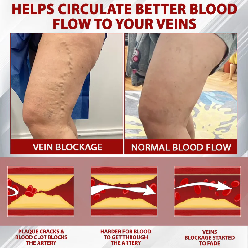 ATTDX® Red Vine FluidRelief Edema Gel 2 ATTDX® Red Vine FluidRelief Edema Gel