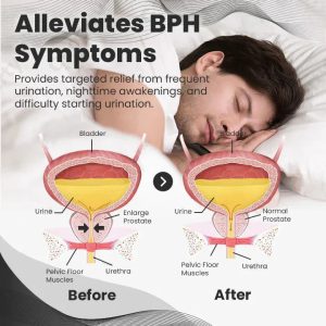 Histone™ Copper Mag Prostate Therapy Ring 16 Histone™ Copper Mag Prostate Therapy Ring