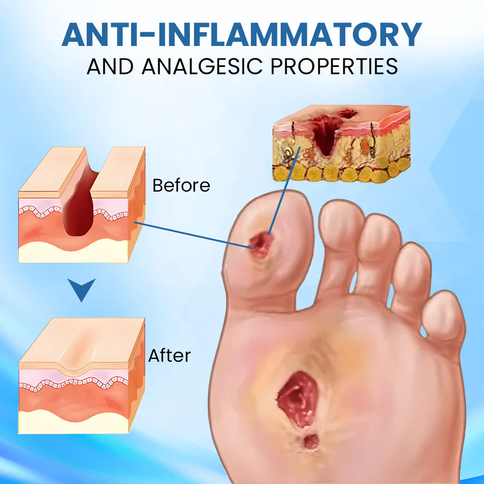 Cvreoz® Diabetic Foot Healing Cream 2 Cvreoz® Diabetic Foot Healing Cream