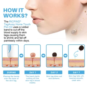 RICPIND® TagAway Home Touch Pen Kit 10 RICPIND® TagAway Home Touch Pen Kit