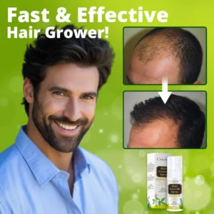 Cvreoz Nourish & Flourish Hair Growth Spray 13 Cvreoz Nourish & Flourish Hair Growth Spray