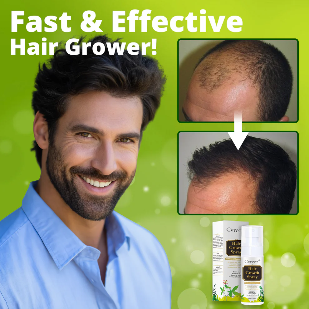 Cvreoz Nourish & Flourish Hair Growth Spray 3 Cvreoz Nourish & Flourish Hair Growth Spray