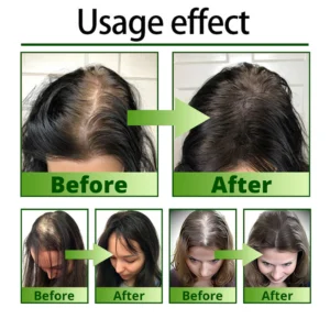 Cvreoz Nourish & Flourish Hair Growth Spray 16 Cvreoz Nourish & Flourish Hair Growth Spray