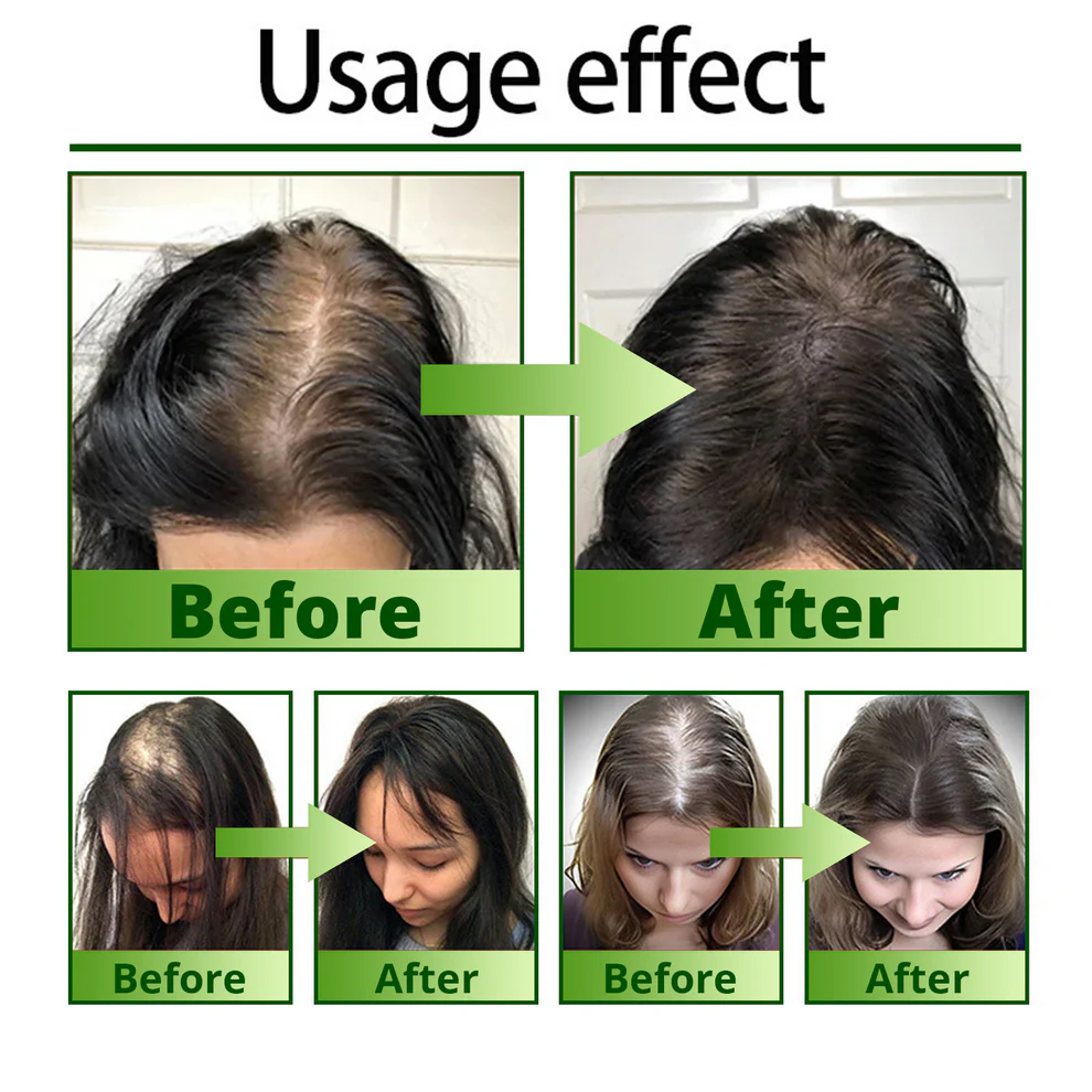 Cvreoz Nourish & Flourish Hair Growth Spray 6 Cvreoz Nourish & Flourish Hair Growth Spray