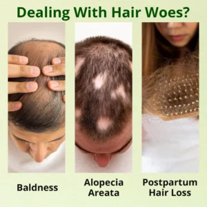 Cvreoz Nourish & Flourish Hair Growth Spray 15 Cvreoz Nourish & Flourish Hair Growth Spray