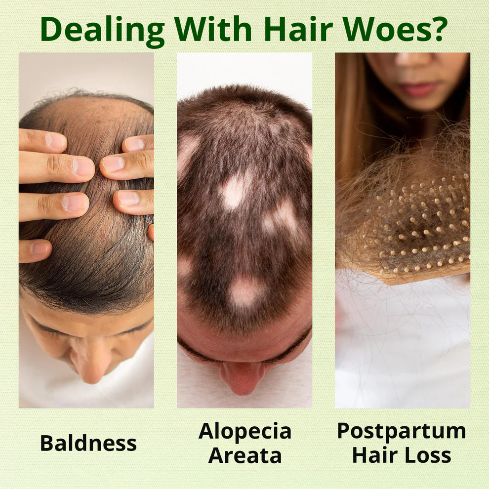 Cvreoz Nourish & Flourish Hair Growth Spray 5 Cvreoz Nourish & Flourish Hair Growth Spray