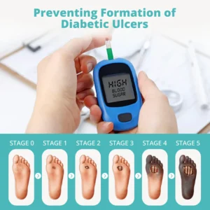 CVREOZ® BioVitaGlyco Diabetes Treatment Cream 12 CVREOZ® BioVitaGlyco Diabetes Treatment Cream