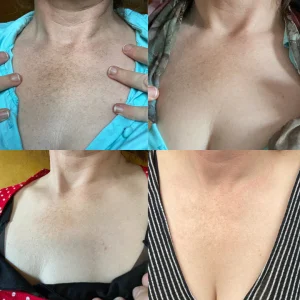 AQA™ Melanin Correcting Facial Serum 13 AQA™ Melanin Correcting Facial Serum