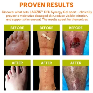 LAOZIK™ DFU Synergy Gel 13 LAOZIK™ DFU Synergy Gel