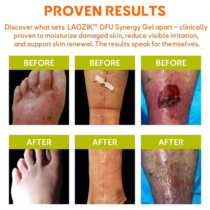 LAOZIK™ DFU Synergy Gel 2 LAOZIK™ DFU Synergy Gel