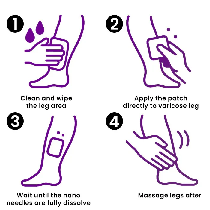 CVREOZ® Polidocanol Nano Varicose Vein Patch 4 CVREOZ® Polidocanol Nano Varicose Vein Patch