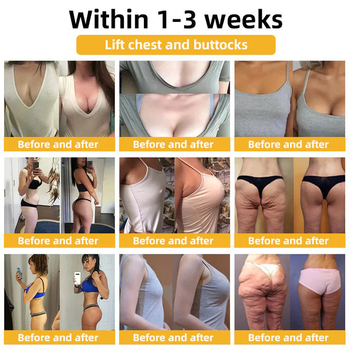 Turonu® Bee Venom Skin Remedy Cream 2 Turonu® Bee Venom Skin Remedy Cream