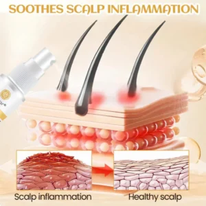 Cvreoz® Ginger Hair Regrowth Serum 17 Cvreoz® Ginger Hair Regrowth Serum