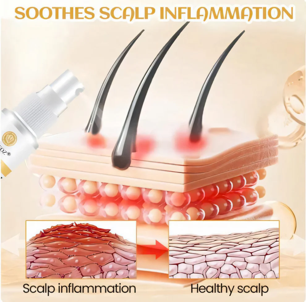 Cvreoz® Ginger Hair Regrowth Serum 7 Cvreoz® Ginger Hair Regrowth Serum