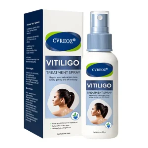 Cvreoz® Vitiligo Treatment Spray 16 Cvreoz® Vitiligo Treatment Spray