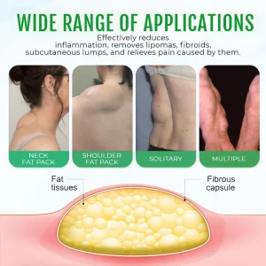 Cvreoz® DermaLump Relief Spray 21 Cvreoz® DermaLump Relief Spray