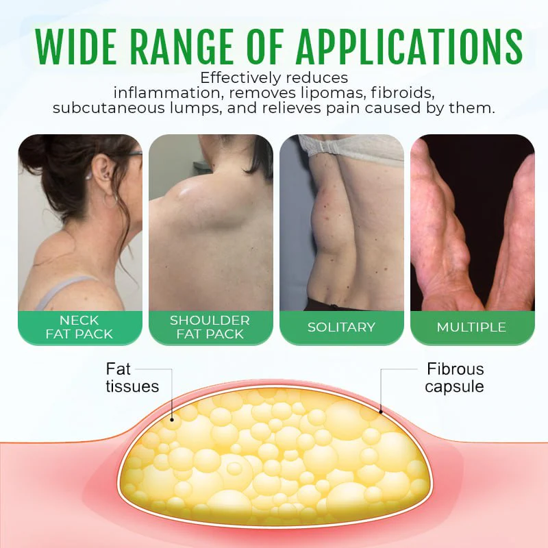 Cvreoz® DermaLump Relief Spray 10 Cvreoz® DermaLump Relief Spray