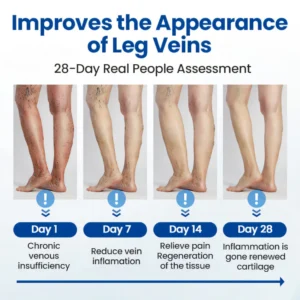 Cvreoz® Varicose Veins Patch 19 Cvreoz® Varicose Veins Patch