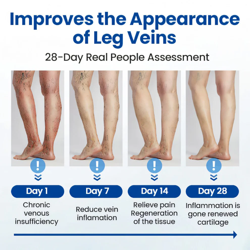 Cvreoz® Varicose Veins Patch 10 Cvreoz® Varicose Veins Patch