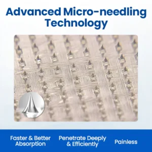 Cvreoz® Varicose Veins Patch 18 Cvreoz® Varicose Veins Patch