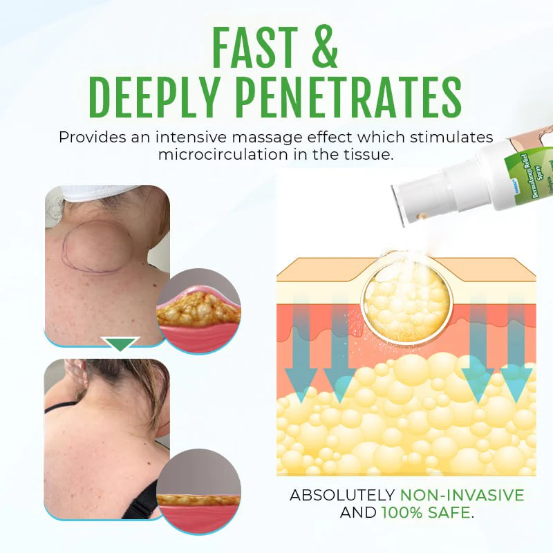 Cvreoz® DermaLump Relief Spray 8 Cvreoz® DermaLump Relief Spray