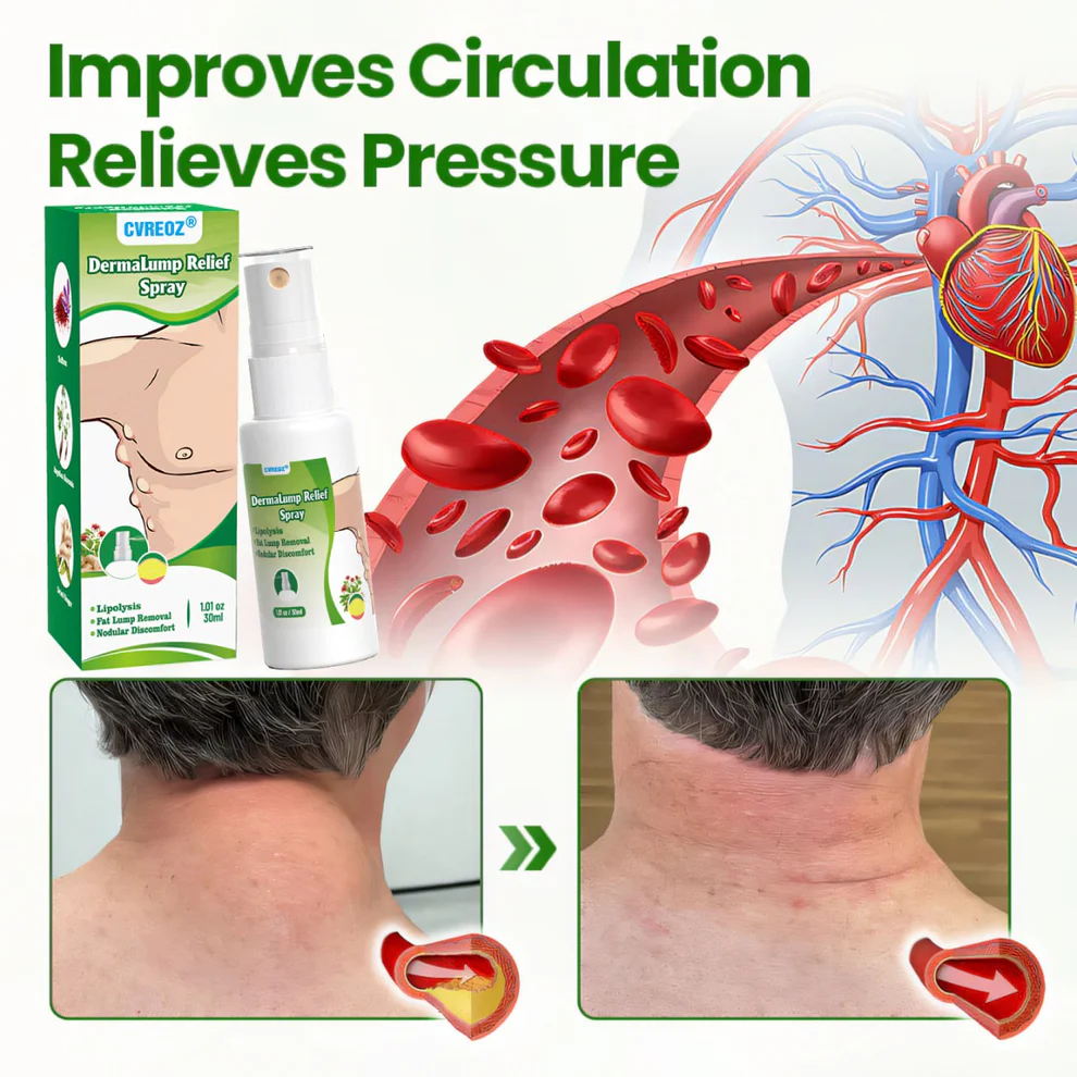 Cvreoz® DermaLump Relief Spray 4 Cvreoz® DermaLump Relief Spray